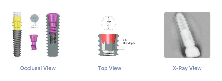 2.1mm Hex Mini - BioThread / Hiossen® Compatible