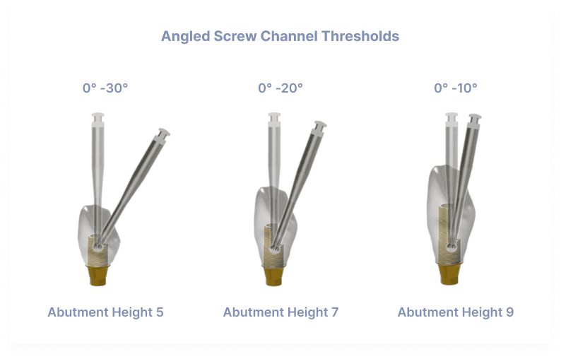 Angled Screw Channel Thresholds