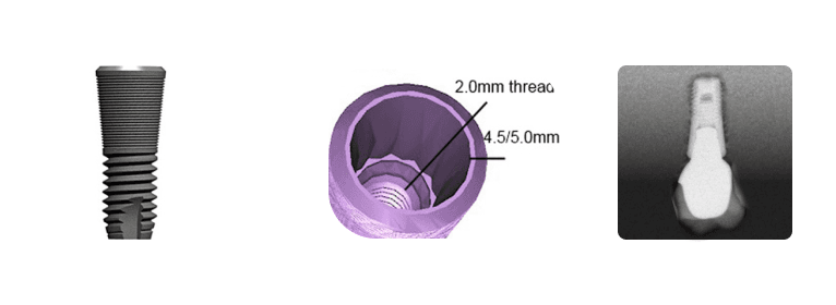 Astra Tech® 4.5-5.0s 