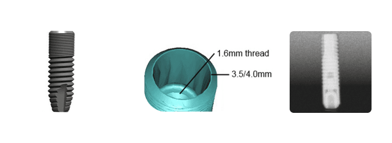 Astra® 3.5-4.0s Aqua