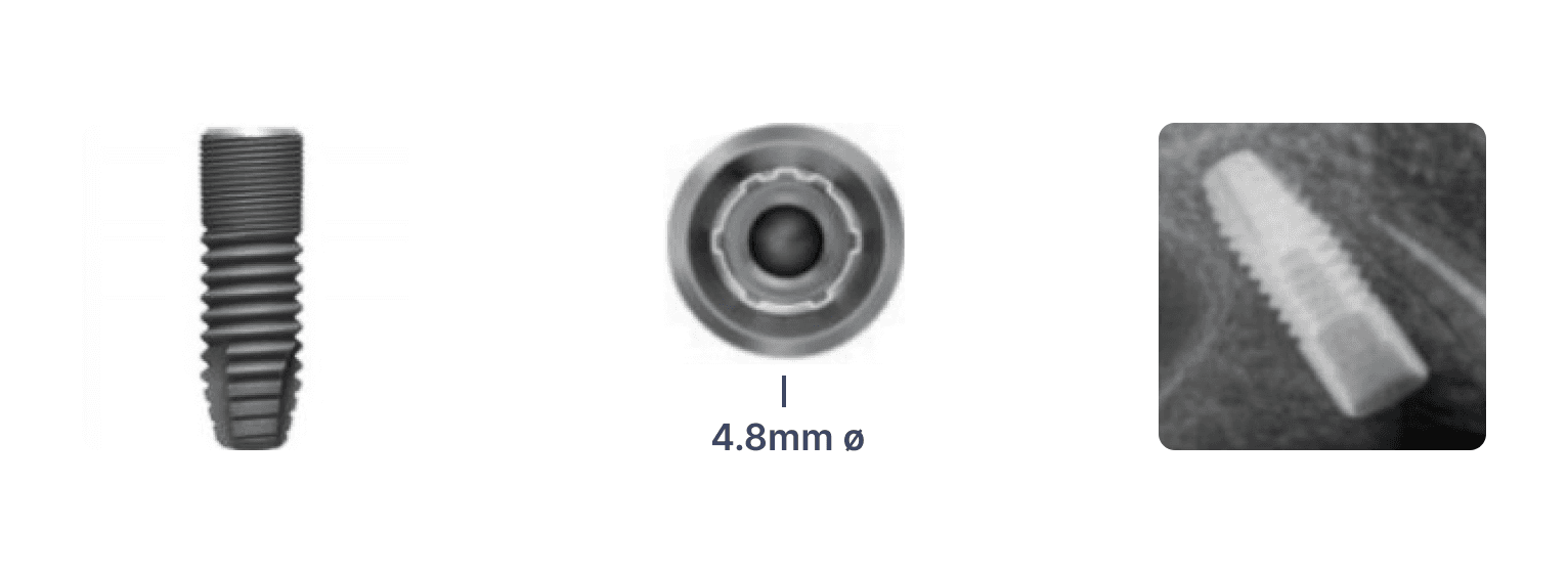 Astra® Tech EV 4.8mm