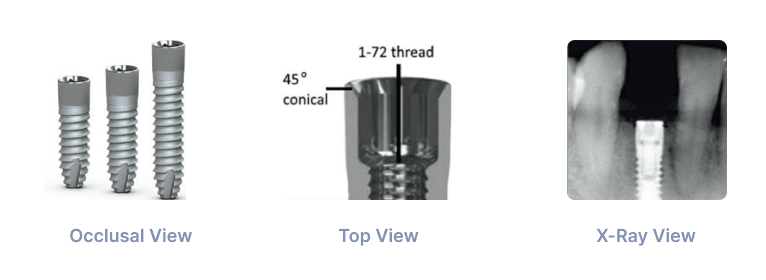 BioHorizon 3.0 Implant