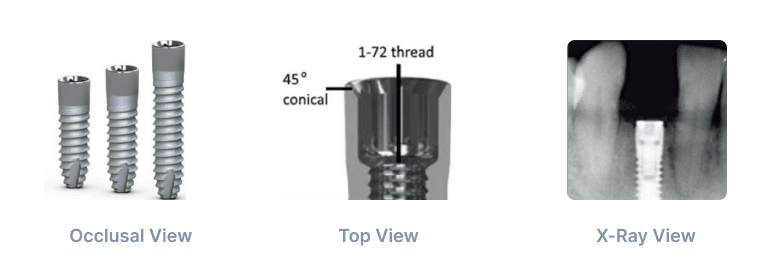 BioHorizon 3.0 Implant