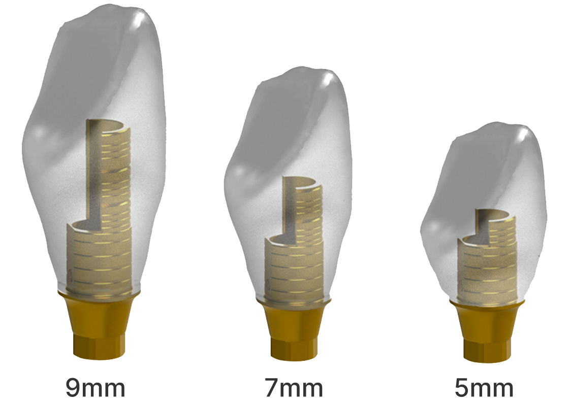 The dental technician then finalizes the restoration design.