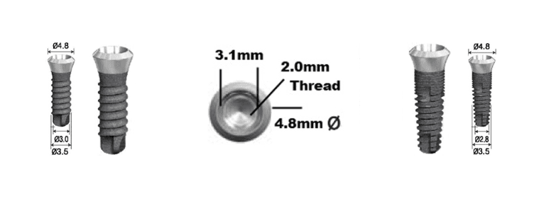 DSI Internal Implant 4.8mm