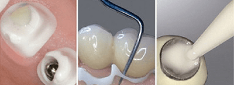 Implantlink