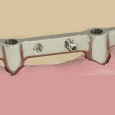 Sagix Attachment System