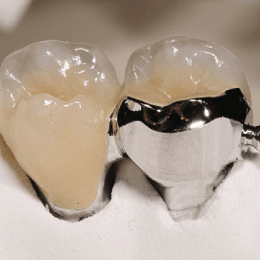 Sagix Attachment System