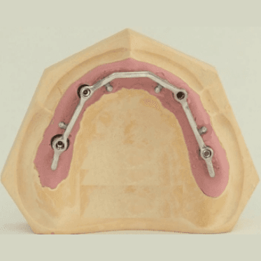 Sagix Attachment System