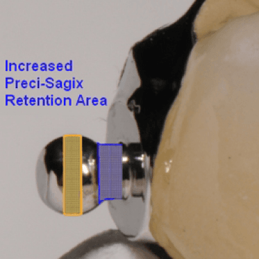 Sagix Attachment System