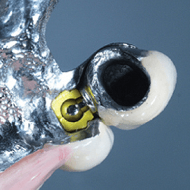 Sagix Attachment System