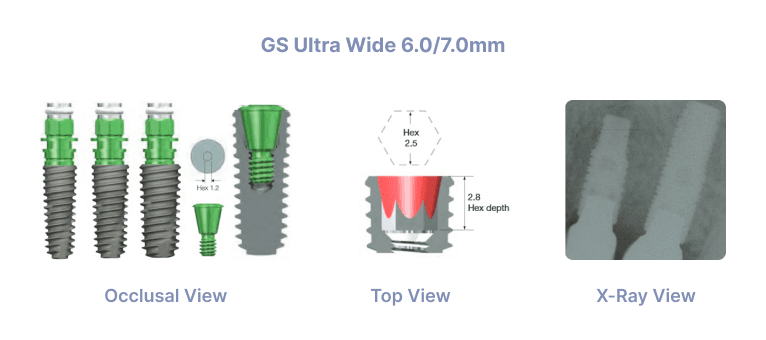 GS Ultra Wide 6.0/7.0mm
