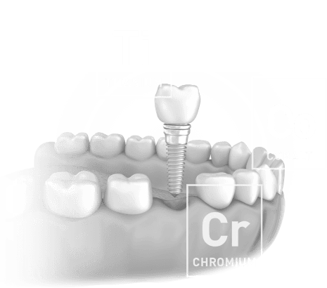 Titanium and Ceramic Chrome Colbalt