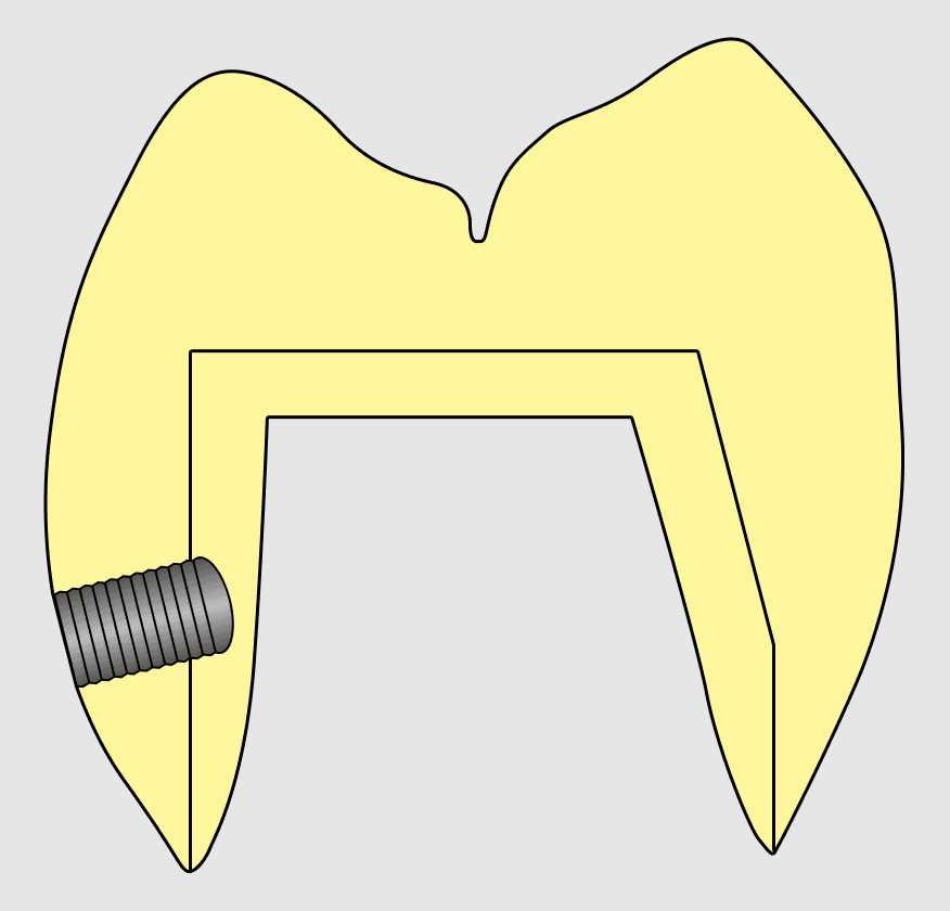 hex pin
