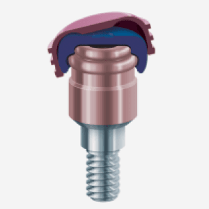 IMZインプラント Twin plus system IMZ Implant TwinPlus Screw type | 歯と口腔外科の役立つお話