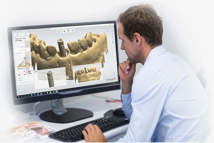 Preat Digital Choice Library - Design Dental Restorations Your Way