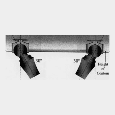 Extracoronal Clix Ball Attachment