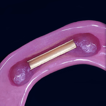 Preci Bar Component