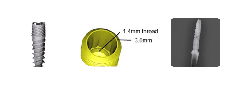 Southern Deep Conical 3.0mm