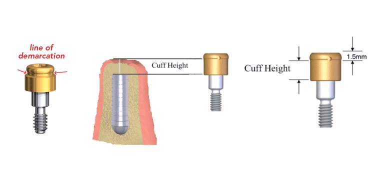 LOCATOR® Implant Attachment Specifications