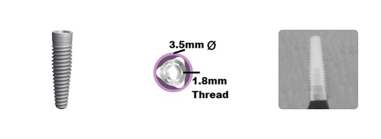 Trilobe NP 3.5mm