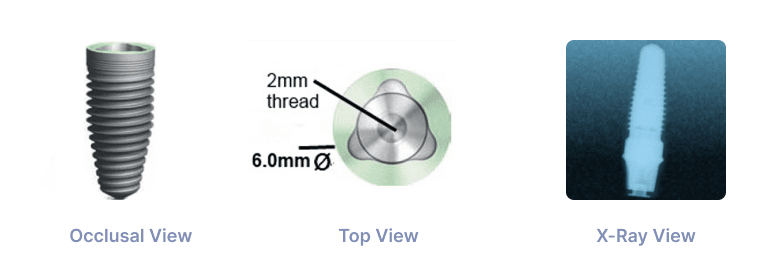 Trilobe 6.0mm