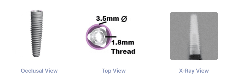 Trilobe NP 3.5mm