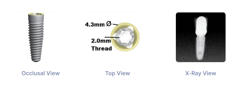 Trilobe RP 4.3mm