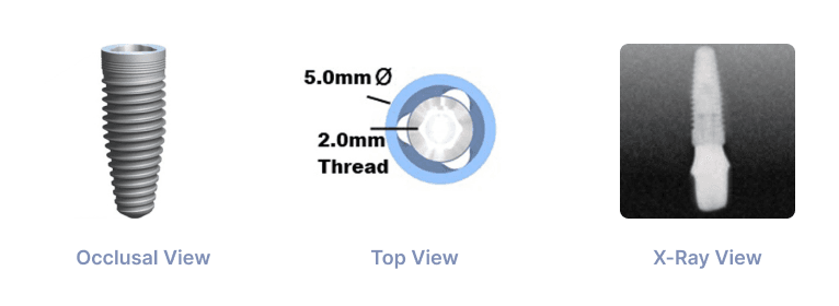 Trilobe WP 5.0mm