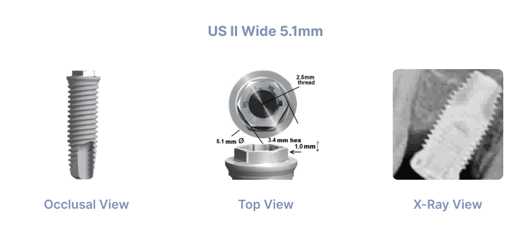 US II Wide 5.1mm