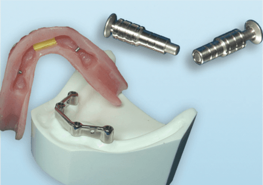 Universal Plunger Loc