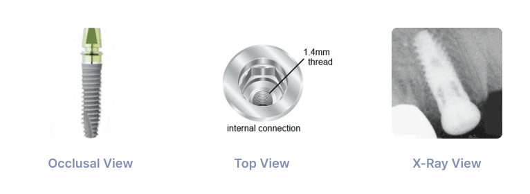 Xive 3.8mm Implant