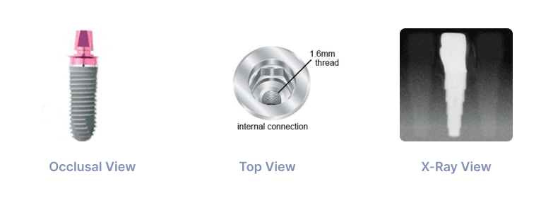 Xive 5.5mm Implant