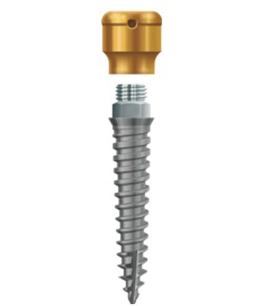 LODI Implant 2.4mm X 12mm, 2.5mm Cuff