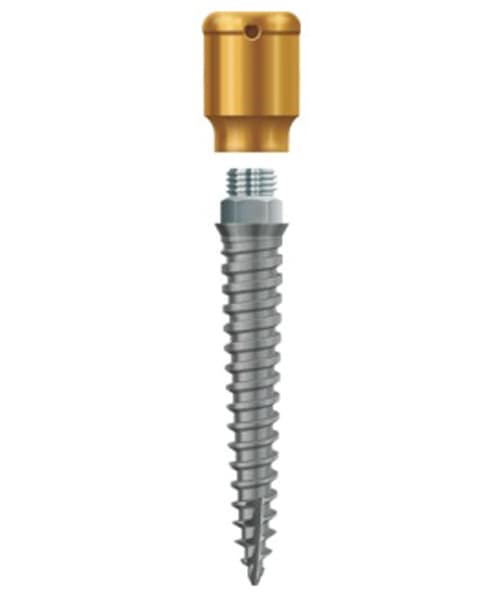 LODI Implant 2.4mm X 14mm, 4mm Cuff