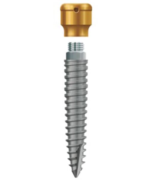 LODI Implant 2.9mm X 14mm, 2.5mm Cuff