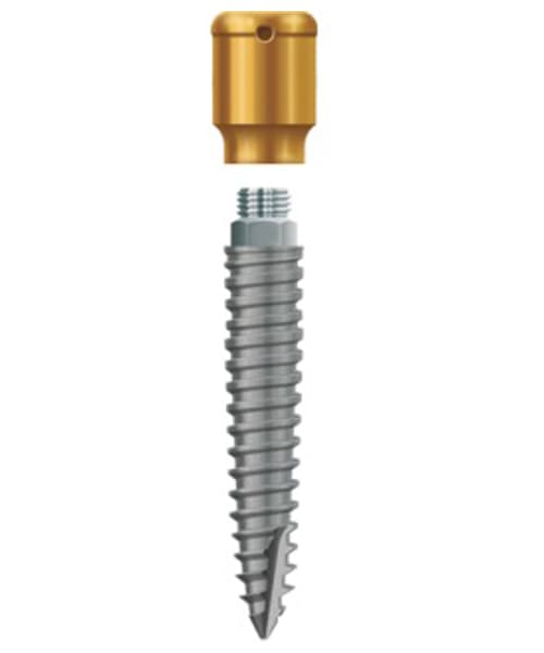 LODI 2.9mm X 14mm, 4mm Cuff