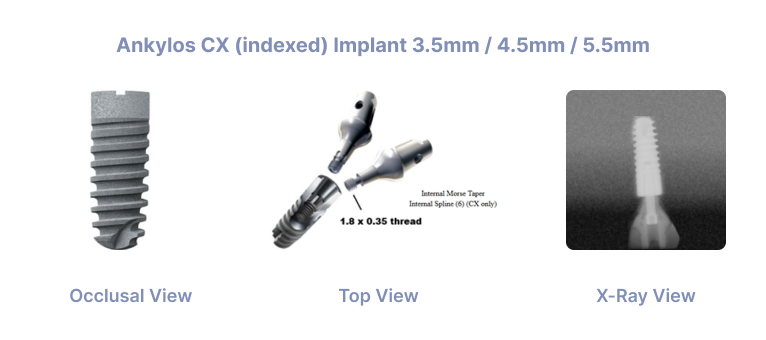 Akylos® CX indexed Implant 3.5mm 4.5mm 5.5mm