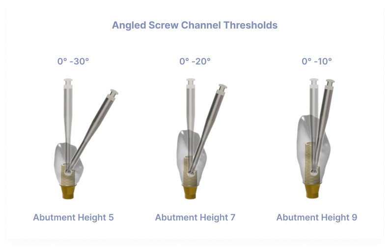 Angled Screw Channel Thresholds