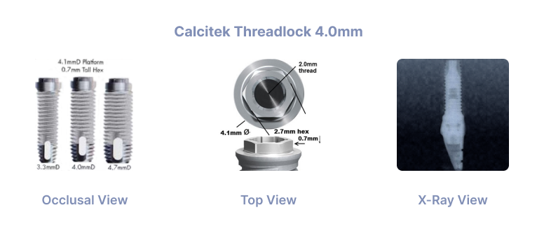 Calcitek Threadlock 4.0mm