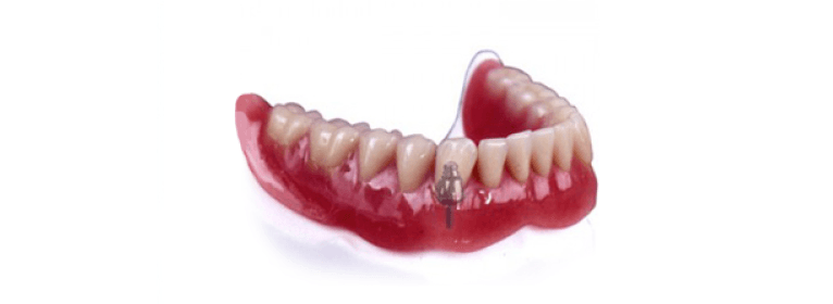 Ceka Revax Axial & Inverted Axial