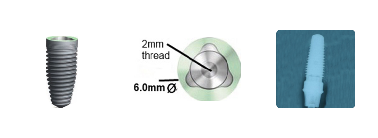 CoAxis TriNeck/TriMax (INTERNAL TRI-LOBE) 6.0/8.0/9.0mm (6.0mmD)