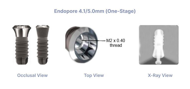 Endopore 4.1/5.0mm (One Stage)