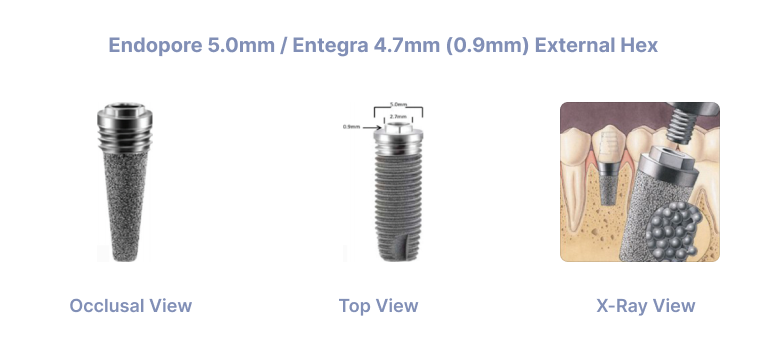 Endopore 5.0mm / Entegra 4.7mm (0.9mm) External Hex