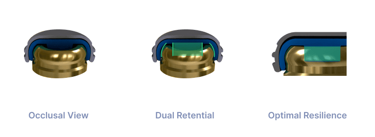 LOCATOR-Feature-Image-Overdenture-Implant