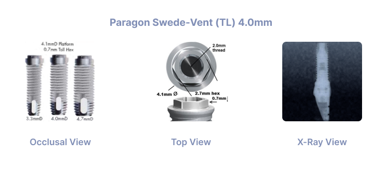 Paragon Swede-Vent TL 4.0mm