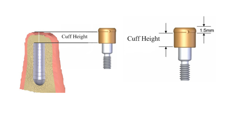 8000080 - Cuff Height Measuring Tool