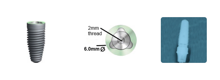 Nobel Biocare® Tri-Lobe 6.0mm