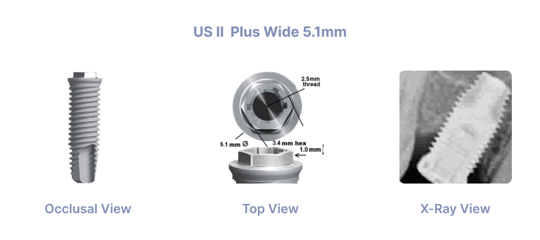 US II Plus Wide 5.1mm
