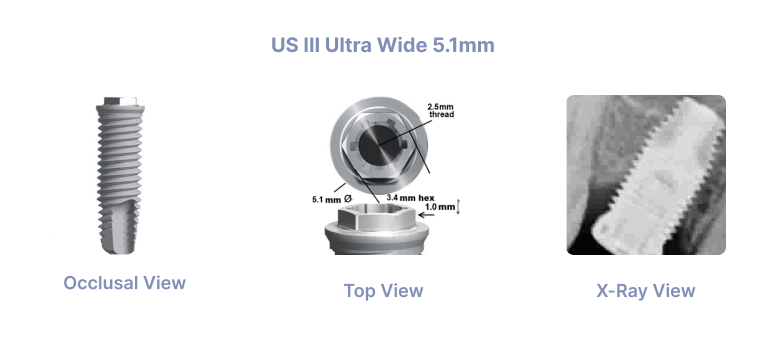 US Ultra Wide 5.1mm
